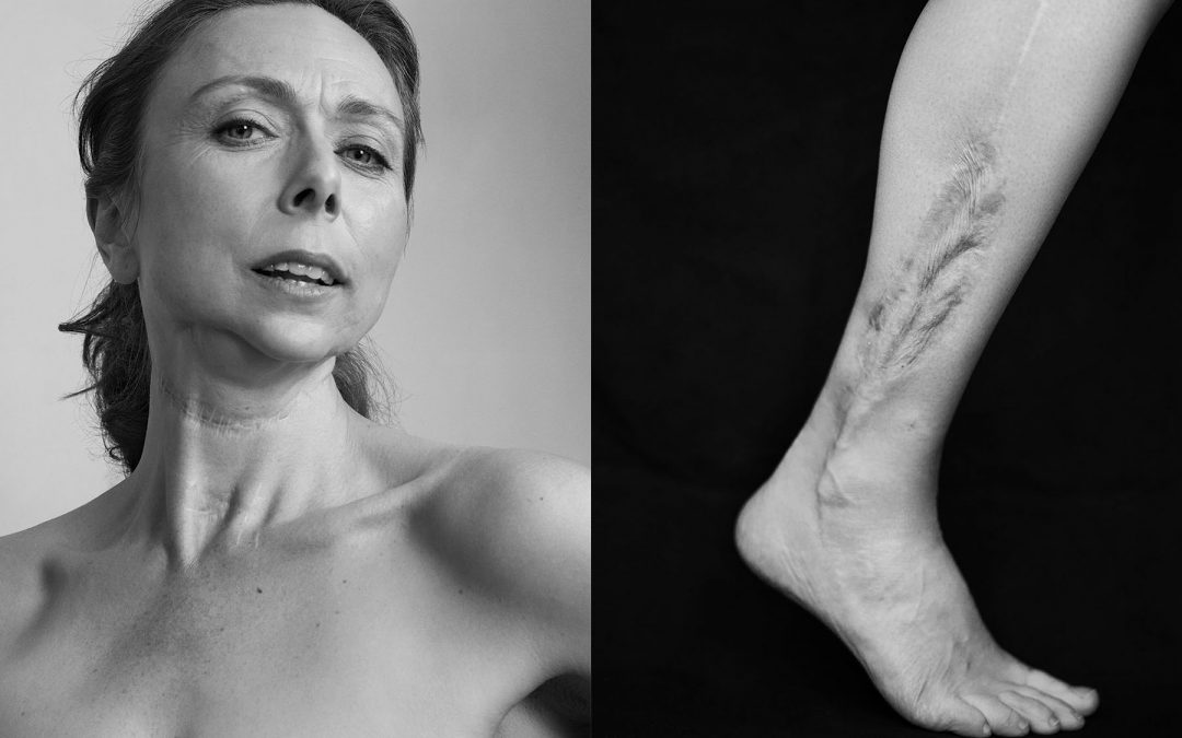 The Skin We’re In: Meet the Changing Faces Ambassadors Redefining Beauty